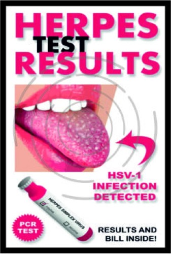 Αποτελέσματα ερπηης image